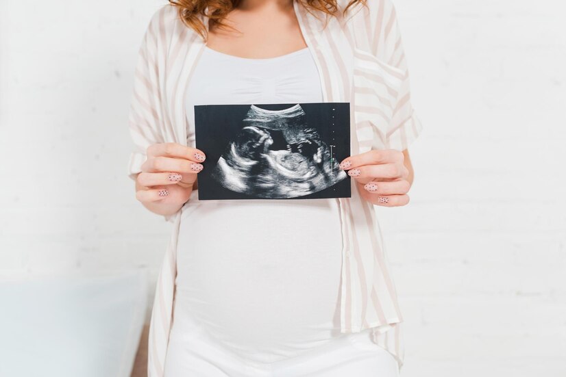 cropped-view-pregnant-girl-showing-ultrasound-scan-baby-bedroom_562859-1100